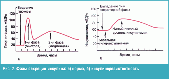 Выделение инсулина в норме и при патологии